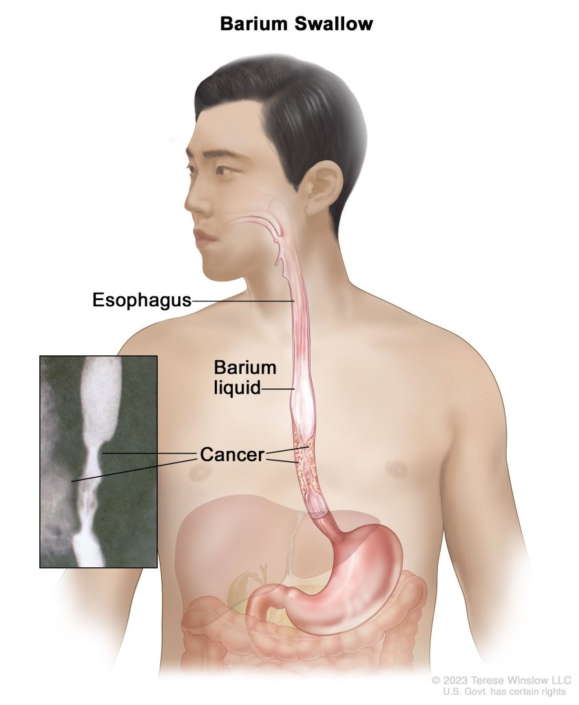 چرا در تصویربرداری از باریم سولفات استفاده می‌شود؟